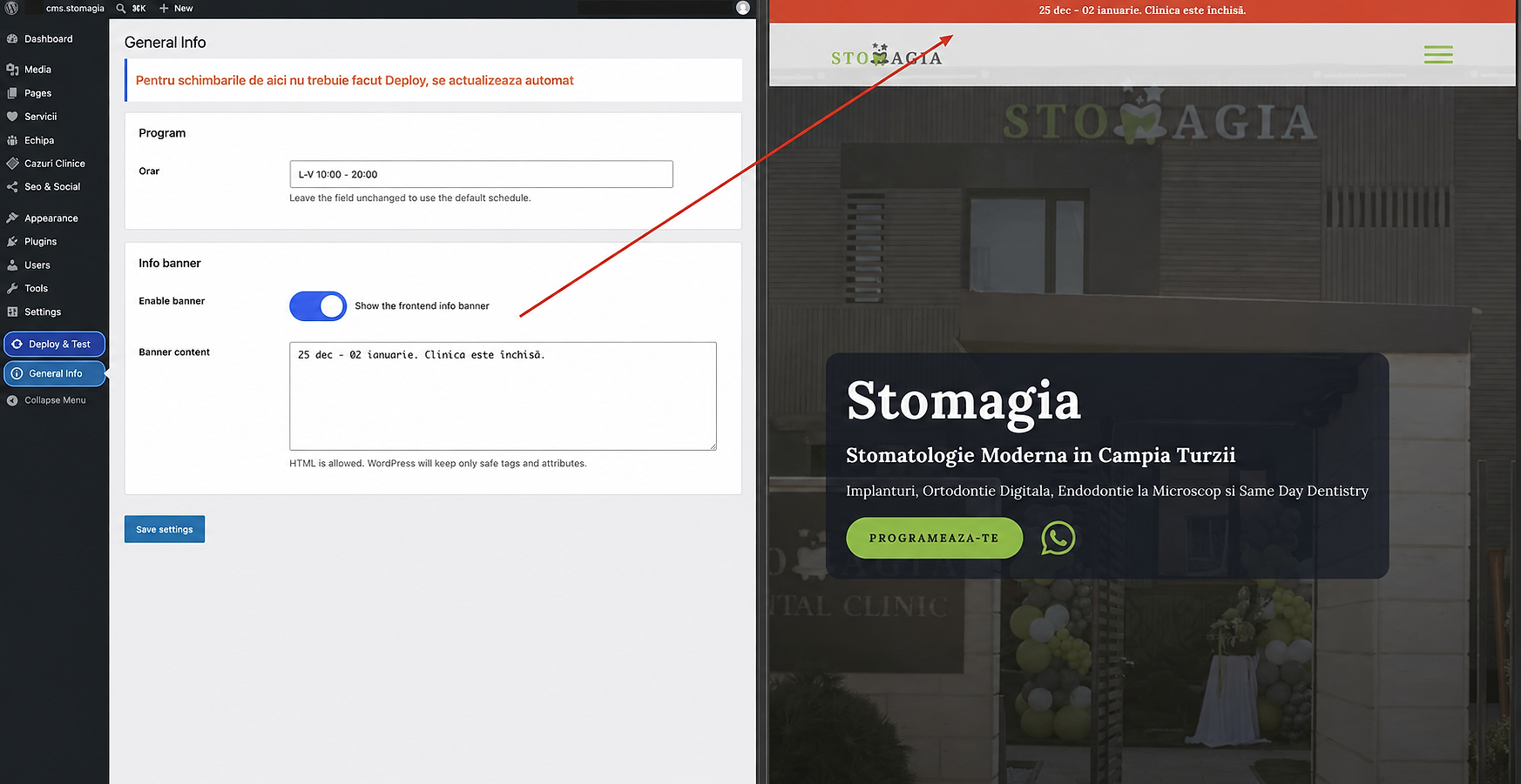 WordPress announcement-banner setting beside the resulting banner on the Stomagia homepage